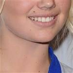 Guess The Celebrity Mustache on fanspics.com